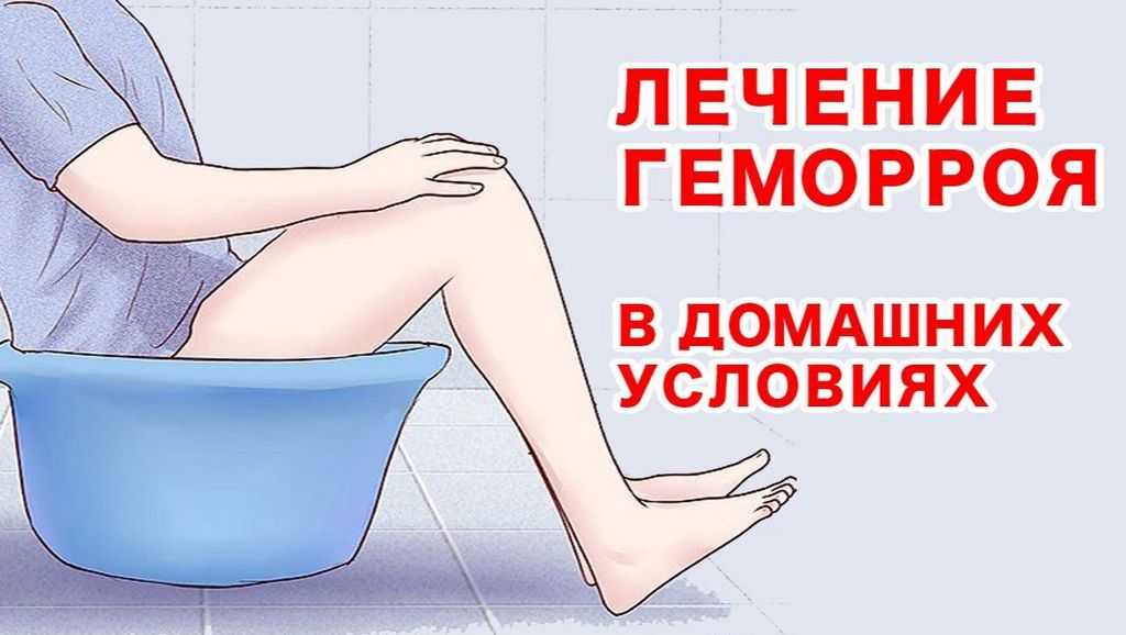 Геморрой кровотечение в домашних условиях Геморрой кровотечение в домашних условиях